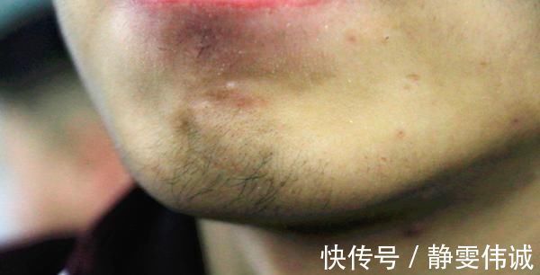 不良习惯|有些男性胡子长得特别快,是什么原因该高兴吗医生给出回复