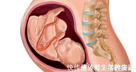 宫口|分娩时,这3种产妇宫口开得快,即使占一个,顺产时会少受很多罪