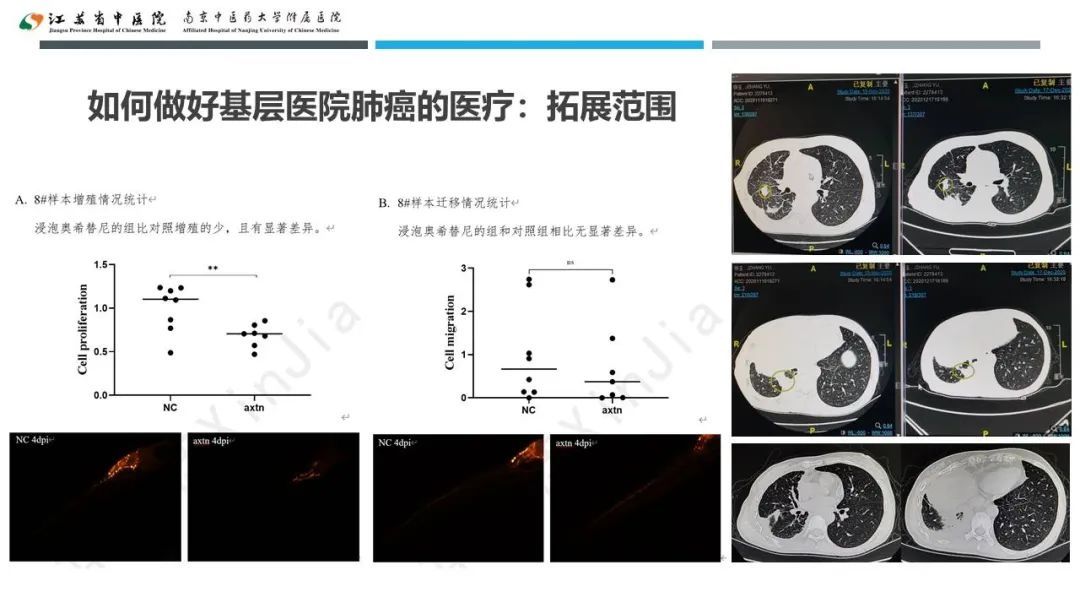 蔡婧|共谋江苏省基层医院肺癌未来发展之路