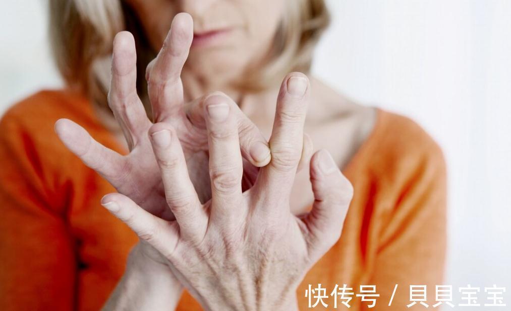 医生|类风湿关节炎有什么症状,你知道吗,医生帮你科普