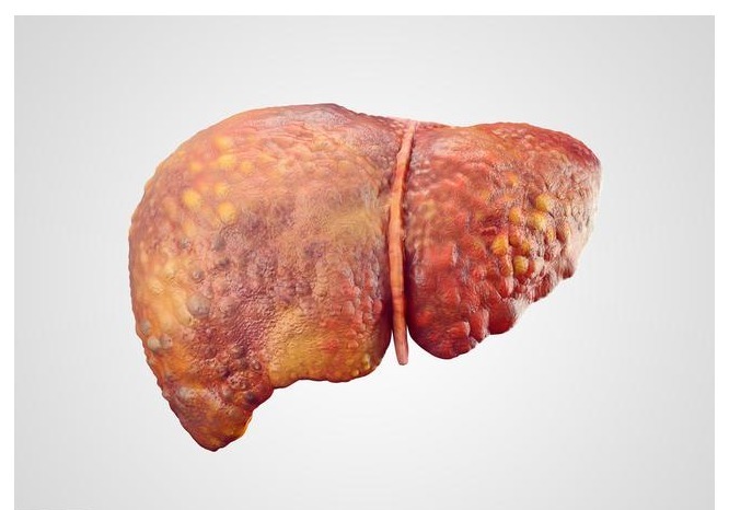 肝脏|从乙肝发展到肝硬化，要多长时间出现这3个症状就要提高警惕了