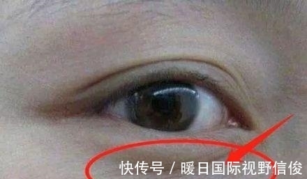 百合|子宫健康的女性,脸上不会有4种表现,常喝1种水,子宫更光滑