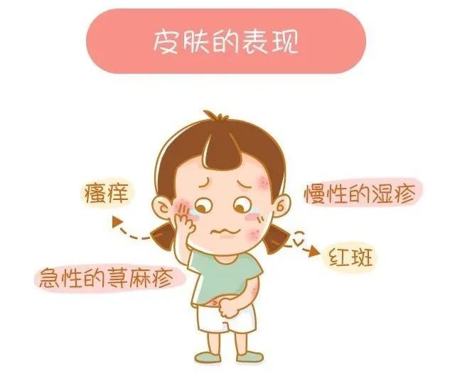 过敏原|卫生健康宣传日：世界过敏性疾病日