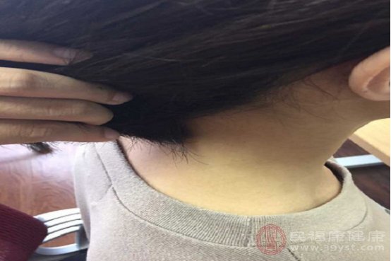 消除颈纹的七个好方法是什么