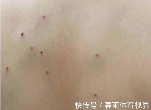 学校|孩子被欺凌、身上20处铅笔尖刺入、差点眼瞎:如何才能保护孩子