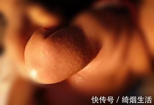 毛孔|宝宝夜里哭闹不止，用梳子刮一刮就好了？别让你的无知“害了”娃