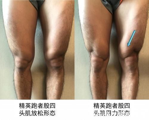 股四头肌|坚持跑步给你留下训练痕迹了吗?跑者的十大形态特征