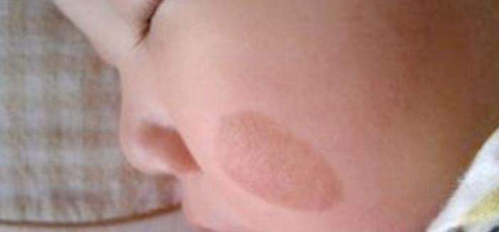 有毒物质|怀孕后，这4件影响宝贝“颜值”的事孕妈最好别做，特别是第一件