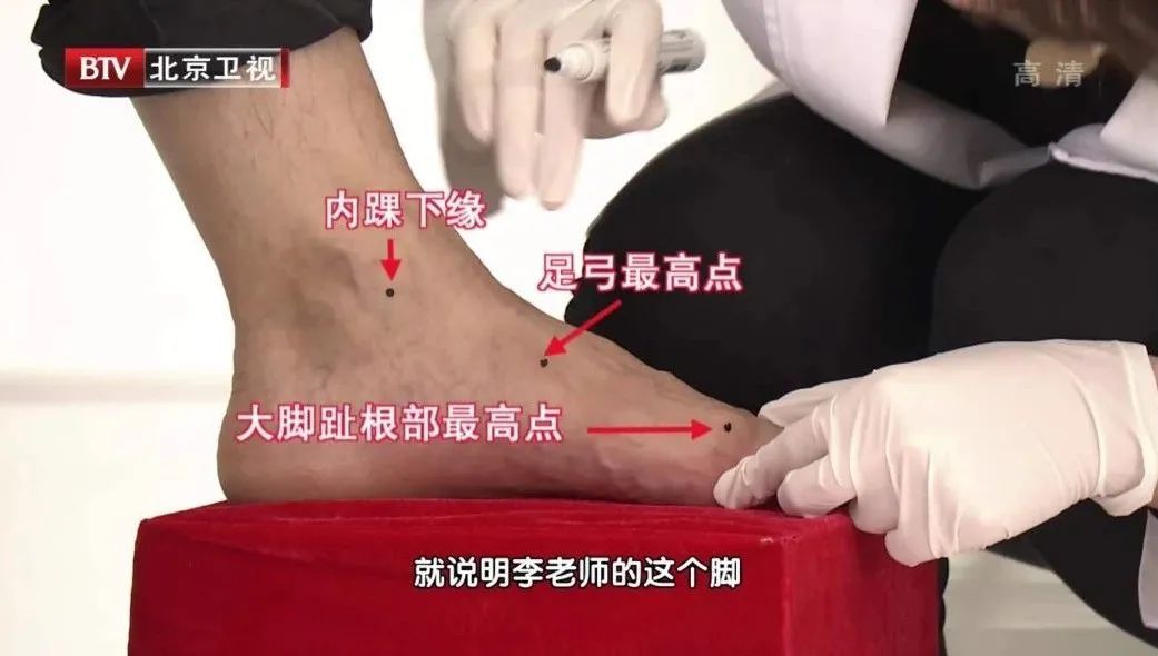 晨起|晨起第一步，脚痛得不得了？你可能是得了这种病 3个动作，帮你减轻疼痛