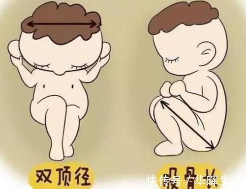 产妇|分娩快慢跟什么因素有关?准妈妈都该了解,这样才是最佳顺产姿势