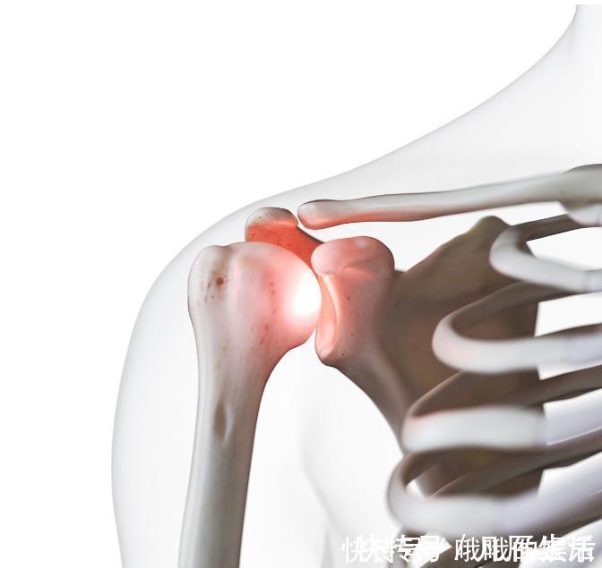 类风湿性关节炎|关节僵硬、肿胀、疼痛该怎么办坚持做好5件事,轻松赶走关节炎