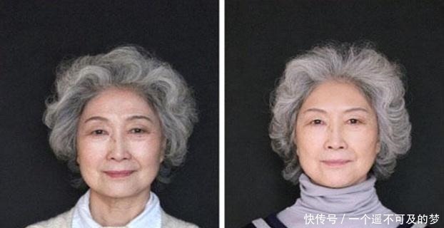 玻尿酸|那些打过“玻尿酸”的人,容貌会有什么变化还好及时知道了!