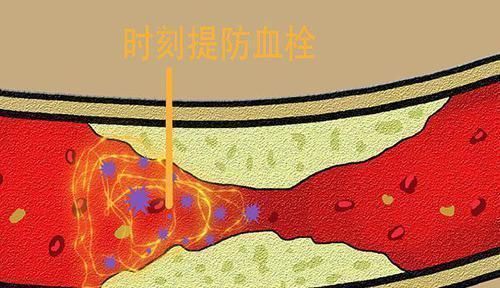 食物|终于找到食物中的“阿司匹林”,适当吃一点,血管中的血栓全消光