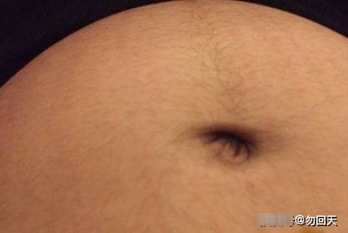 孕肚|生男生女？可以从孕肚上的一条神秘“黑线”看出？答案让人暖心