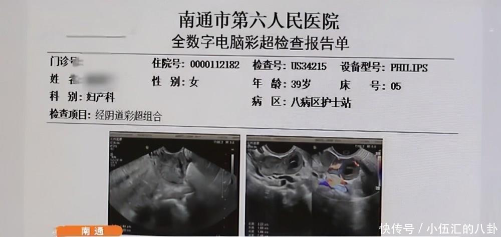 怀孕|39岁女子宫内宫外同时受孕“鬼门关”外走一遭
