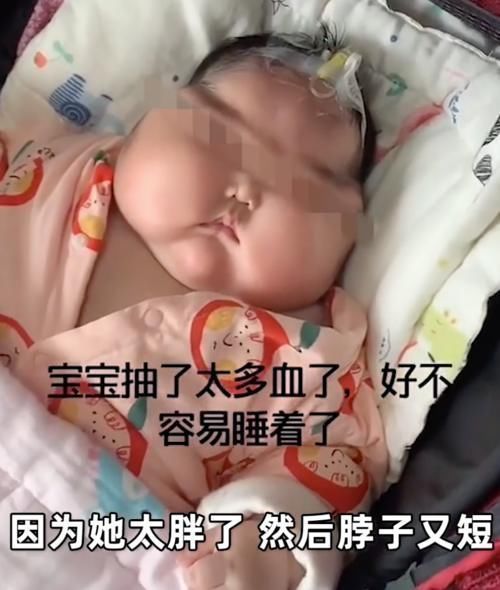 大v|“大头娃娃”再次出现,额头长满汗毛,这次是“毒护肤霜”惹的祸