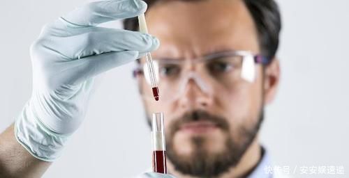 肝脏|肝硬化才不会“悄无声息”,早期信号一定别忽视,还好早知道