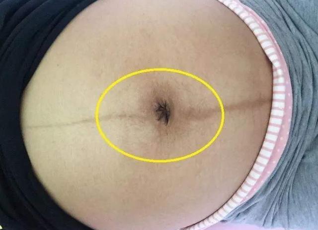 怀孕期间,肚子里是男孩还是女孩4种症状帮你判断,建议收藏