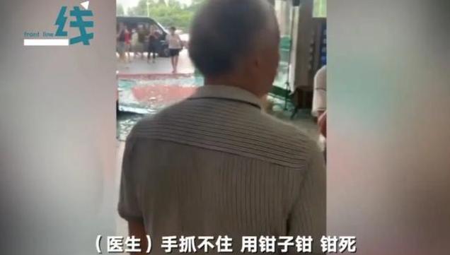 死亡|孕妇破水15小时,生产后娃“意外”死亡,家属孩子是被产钳夹死
