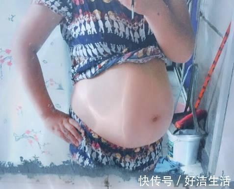 怀孕期间|孕期人机不离身,准妈妈对辐射不以为然,胚胎被诊断畸形