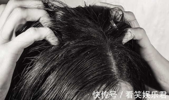 恶化|3种食物会加速肝病恶化,奉劝趁早拉黑!这样养肝才更有效