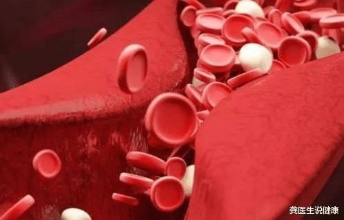 王院士|退休院士亲身经历:甘油三酯3.9,戒掉“2物”后,半年时间血脂恢复正常