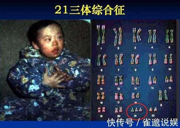 b超|有种产检叫“准爸爸不能缺席”,这5项产检,准爸爸再忙也要来