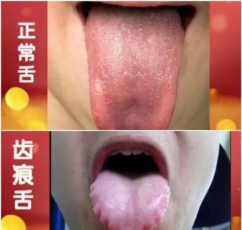 生病|脾胃差，鸡内金与它们搭配，经常喝一点，补五脏少生病！