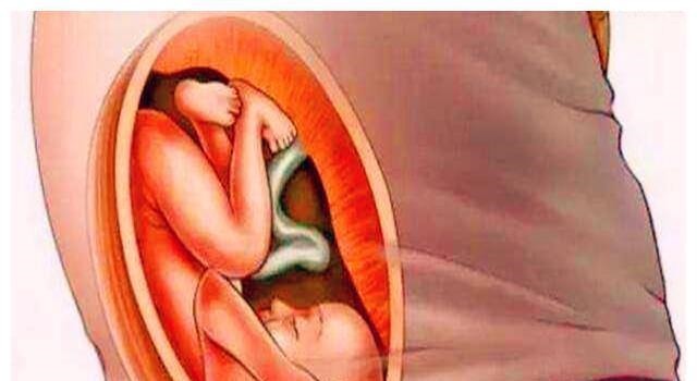 暴涨期|胎儿在宫内是如何发育成型的?十张图读懂胎儿发育过程,都该看看