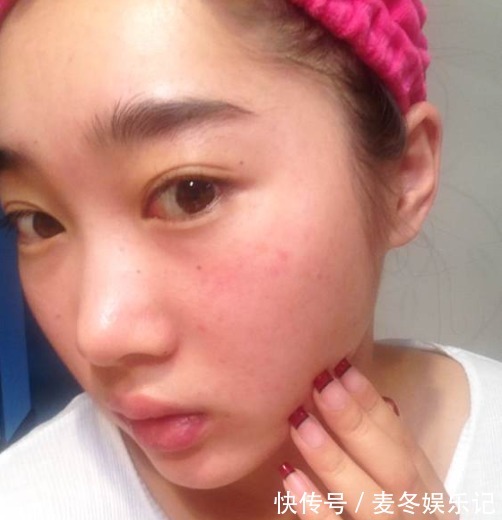 角质层|敷面膜的女人,10年后会怎样?会比别人年轻吗?最靠谱的回答在这