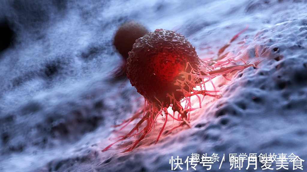 癌症|如果四个症状全都没有,恭喜你没有癌症,三类人群不妨自测一下