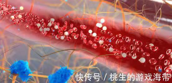 血管堵塞|1种“零嘴”,正在偷偷提高你的血脂,医生提醒:40岁后要少吃