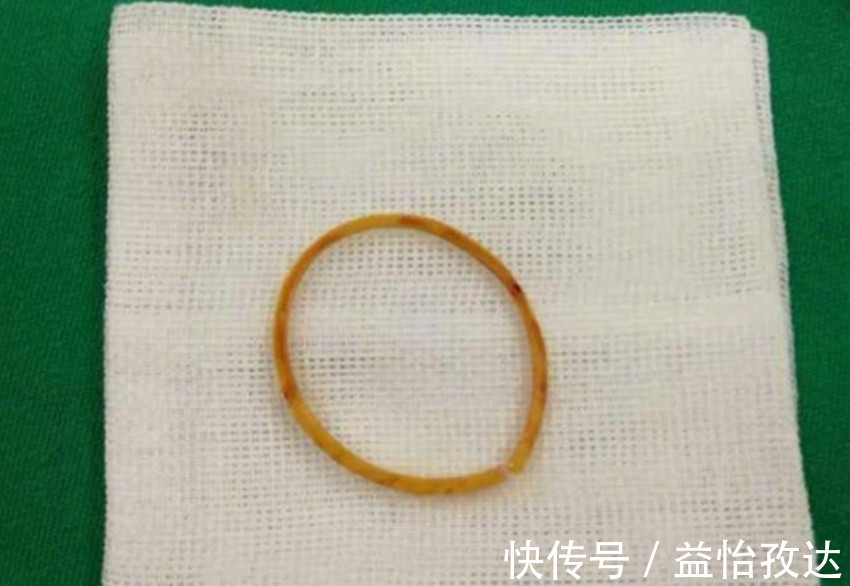 铆钉|三岁女孩一直说手臂疼,送到医院检查后,医生说你们差点后悔一生