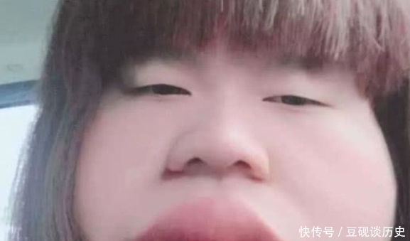 嘴唇|女生有这3习惯?难怪嘴唇“越来越厚”,再不改小心变成“猪圈嘴”!