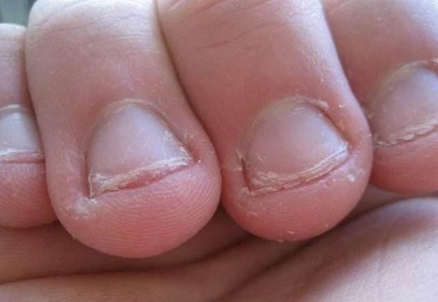 习惯性|为什么孩子总爱“咬指甲”?是什么原因?将来都逃不过这几种结局