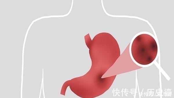 小酒|小酒怡情、大酒伤身,那个时间段喝酒,对身体伤害较大?医生回答