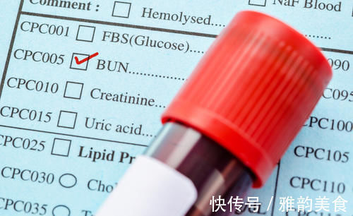 bun|關于腎功能，體檢化驗單上的這些參考值，你讀懂了嗎？