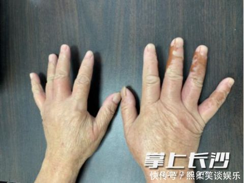 紧急提醒!街头出现的这东西千万别乱吃!严重可致命