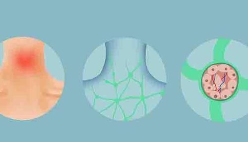 手术治疗|癌症患者做完手术，已经把肿瘤切干净了，为何之后却还是复发了