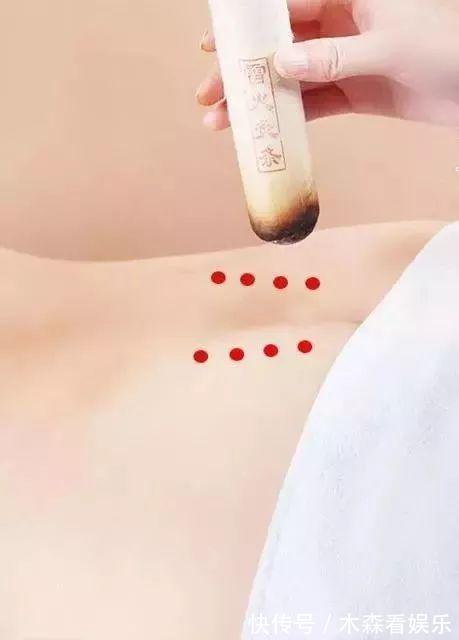 健康|上热下寒太痛苦,教您几招引火归元,把火引下来,健康轻松每一天