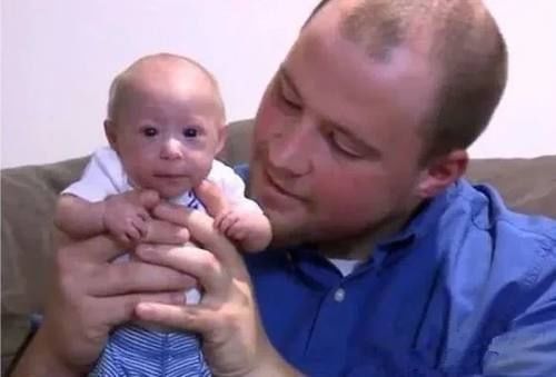 婴儿|婴儿刚出生就被判侏儒症停止发育,父母不愿放弃如今变成这样!