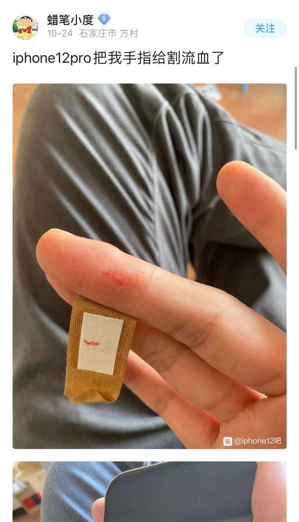 iPhone|多位网友手被割流血!iPhone 12直角边框太凌厉