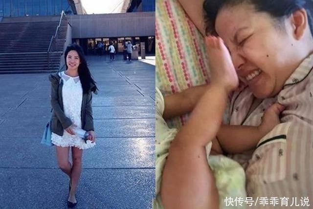 妊娠纹|一组女性生娃前后“对比图”火了,隐藏了妊娠纹,差距也显而易见