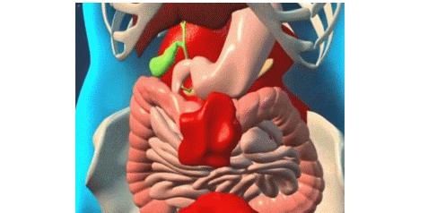 肚子|女子肚子里长了个肿瘤 30斤！差不多有5个新生儿那样重