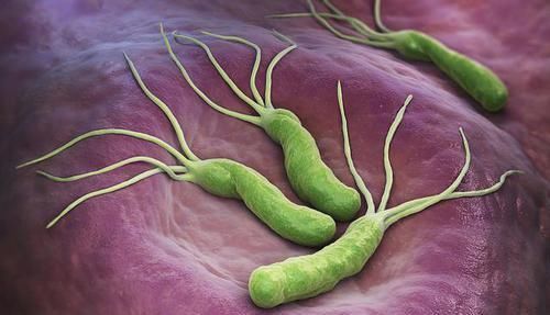 调理|33岁男子幽门螺杆菌400，伴有胃炎，坚持吃1物，胃变强，幽门跑了