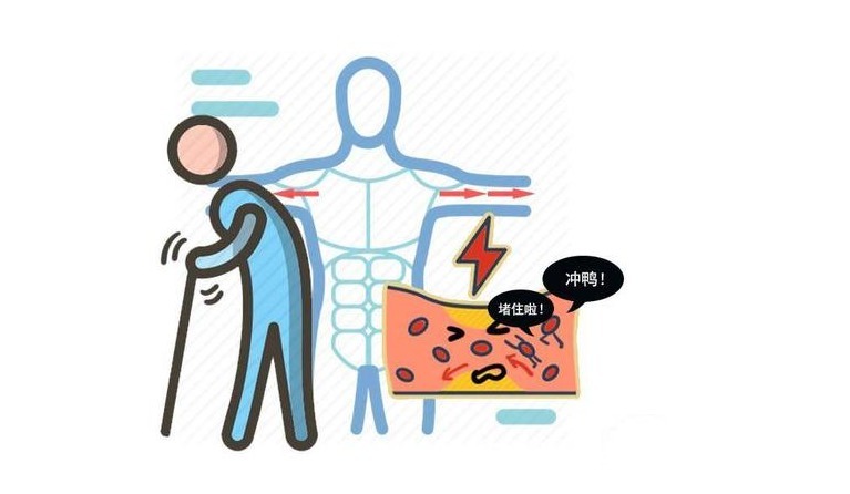 黑木耳|血管需要定期清理,每天适量吃7种食物,阻止血栓,软化血管