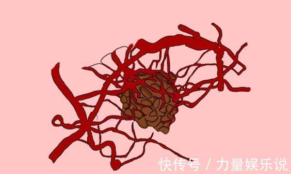 体质|拥有抗癌体质的人,都具备什么特征若你全都符合,身体不会太差