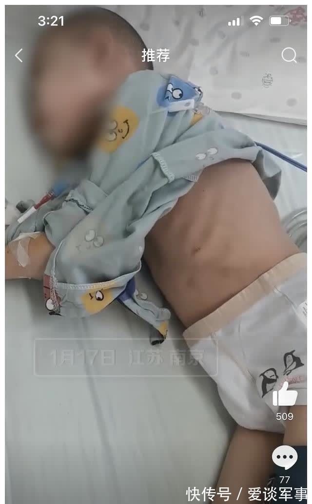 消毒|7岁男童骨髓移植后自己用棉签消毒,抽血时从来不哭,想快点上学