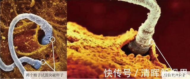 卵子|10月胎儿形成全过程,8张图带你了解真相,感受生命的奇迹