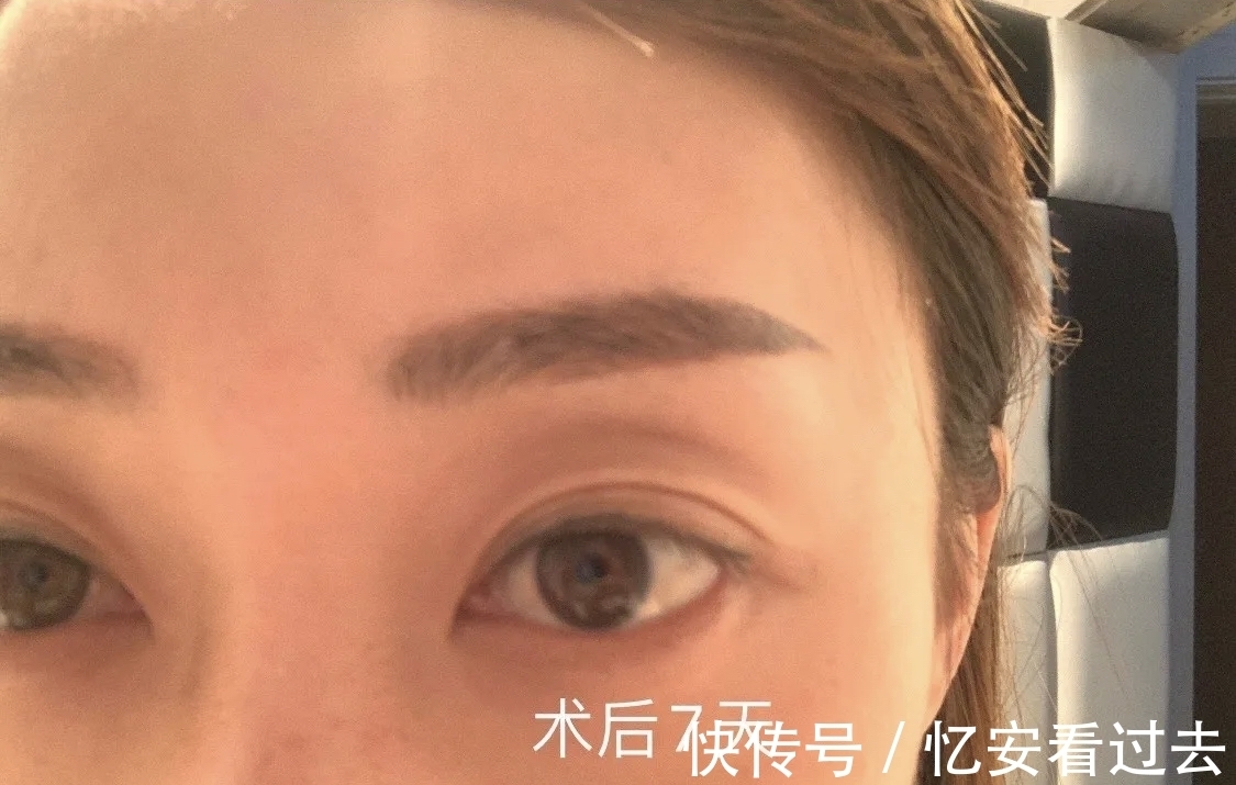 项目|别以为秒杀的医美项目是赚到!